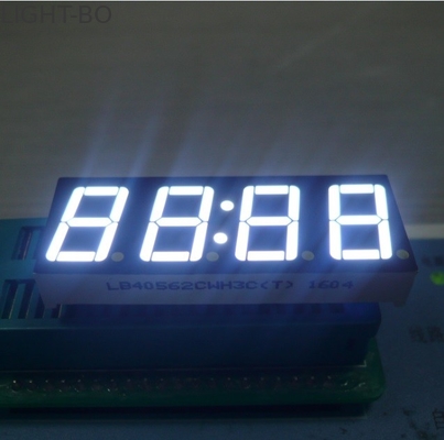 Esposizione per il temporizzatore del forno a microonde, esposizione dell'orologio del LED dell'orologio di Digital